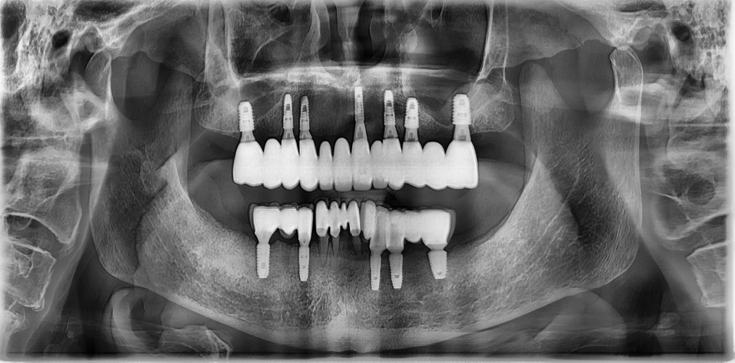 치료 후 이미지