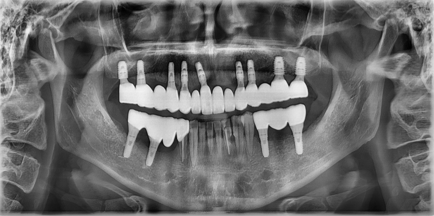 치료 후 이미지