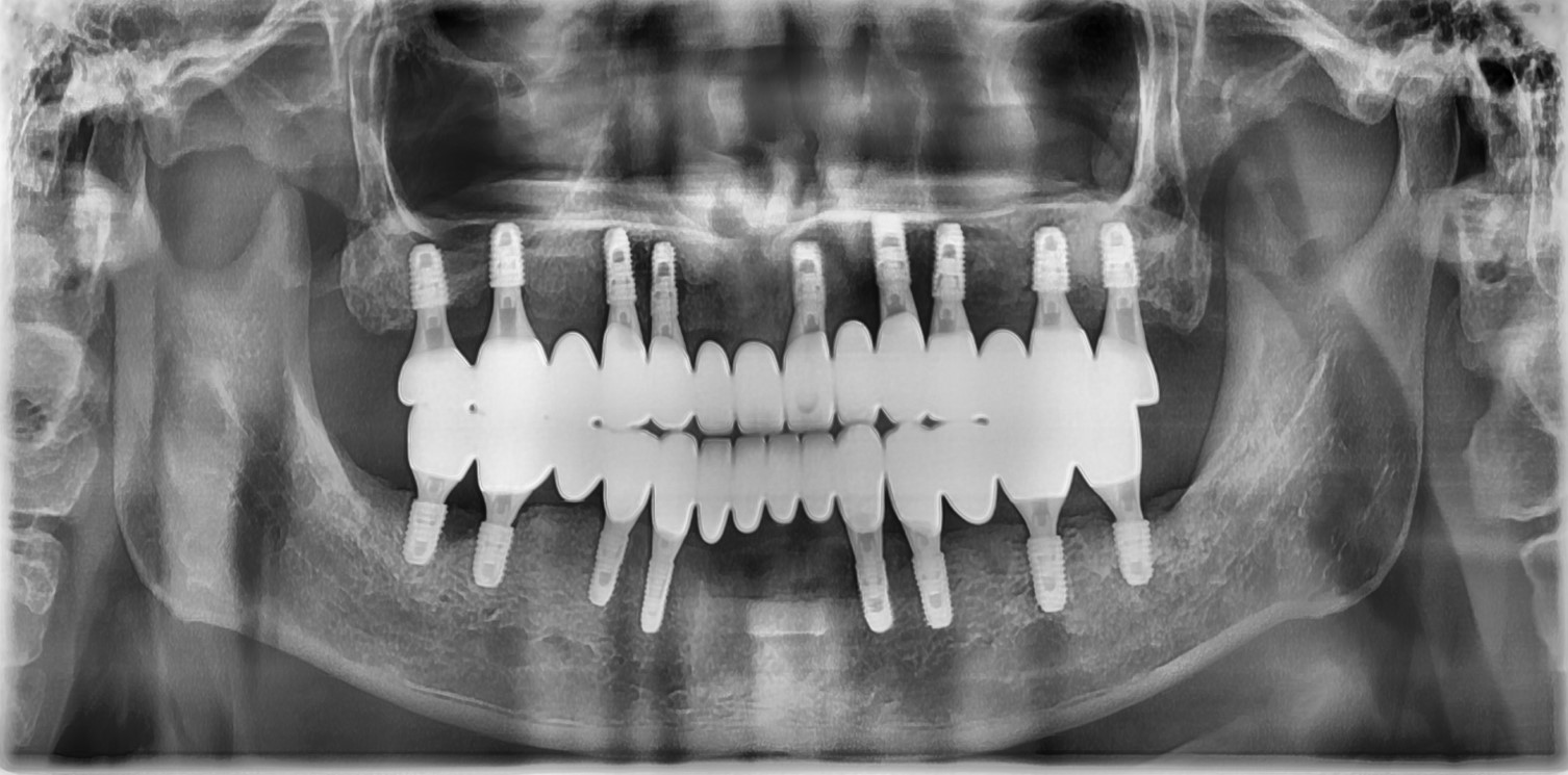 치료 후 이미지