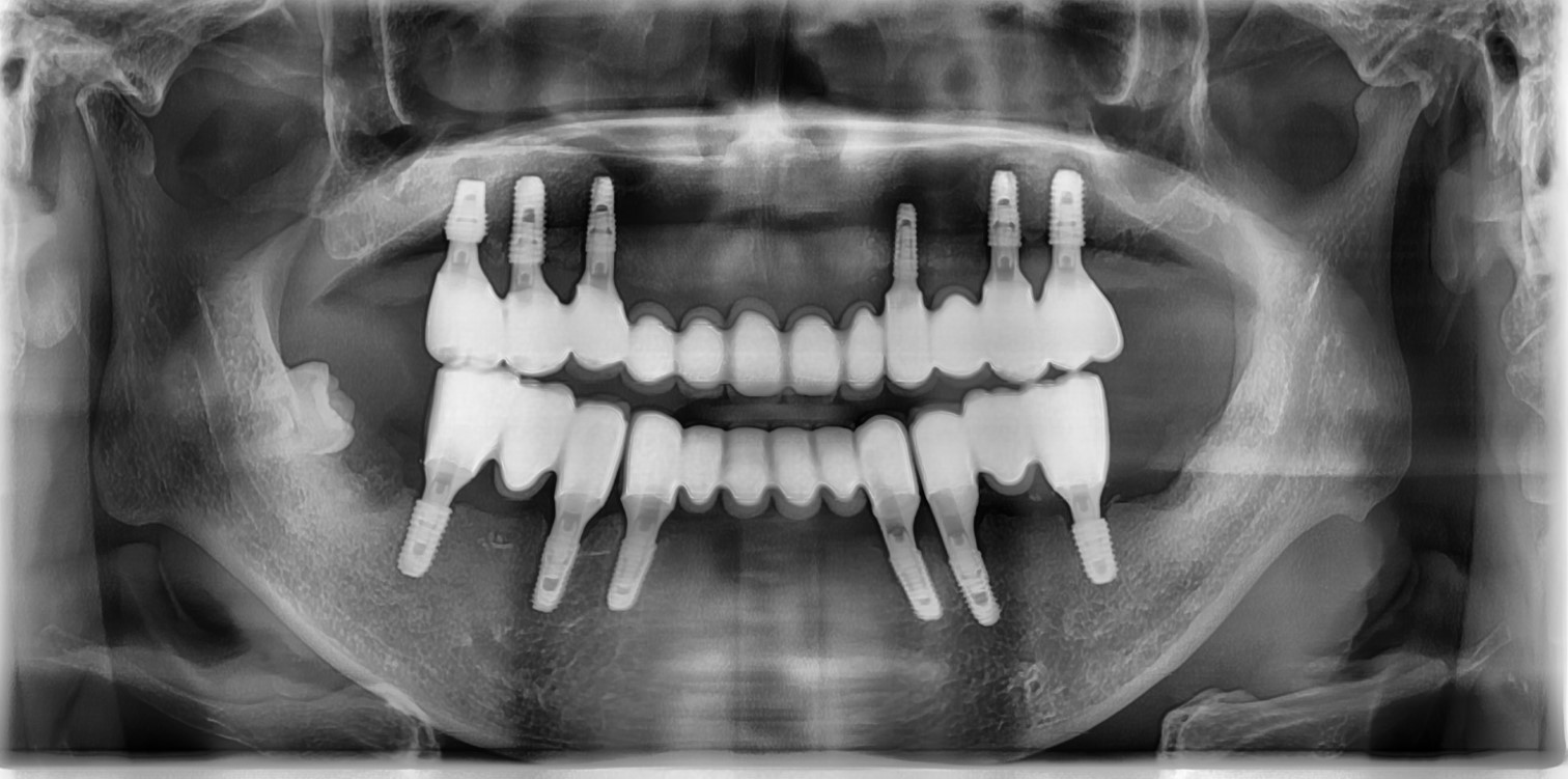 치료 후 이미지