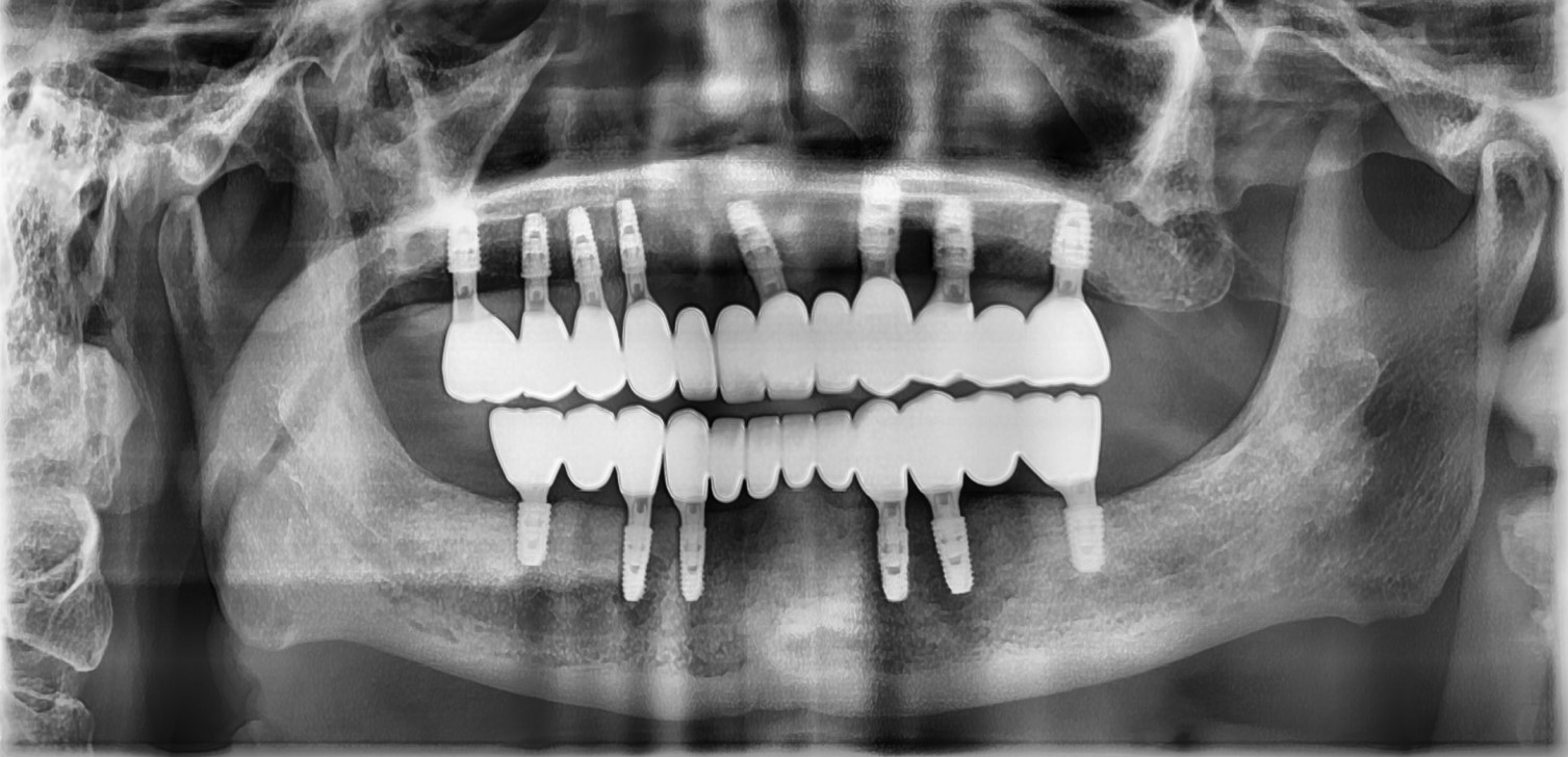 치료 후 이미지