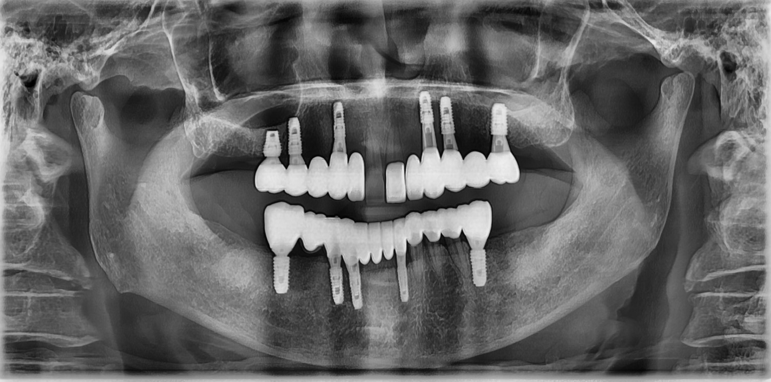 치료 후 이미지